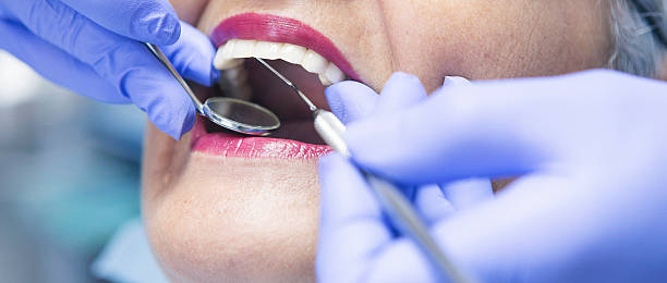 Best Emergency Wisdom Teeth Removal in Caledonia, MI